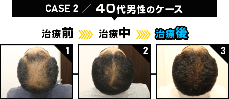 CASE2 40代男性のケース