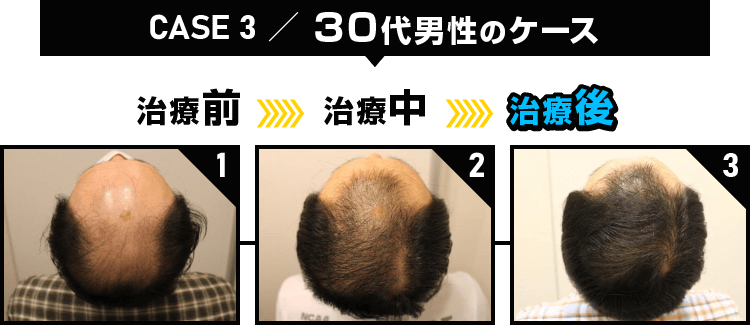 CASE3 30代男性のケース