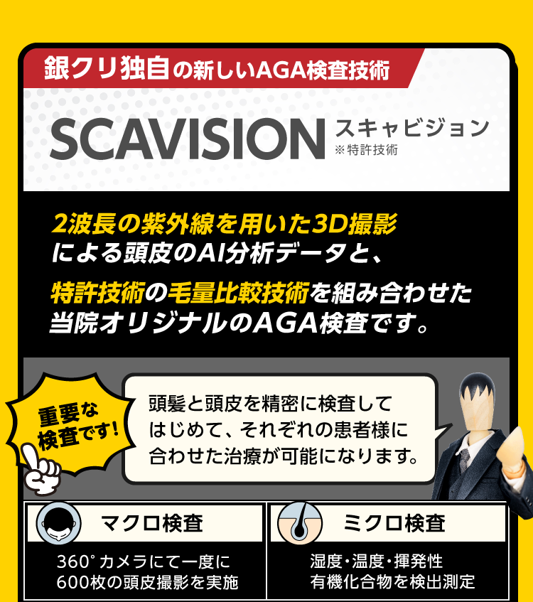 スキャビジョン