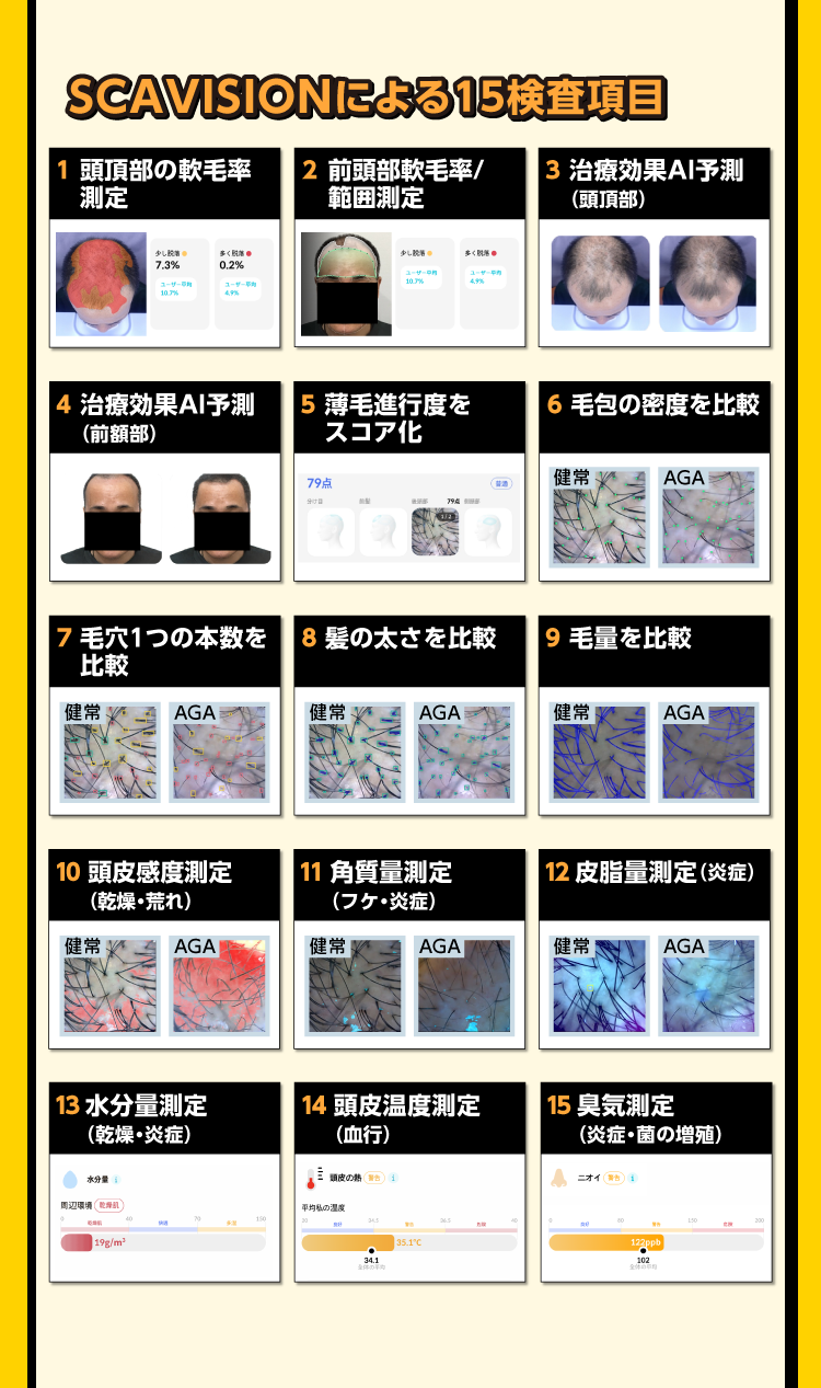 スキャビジョン