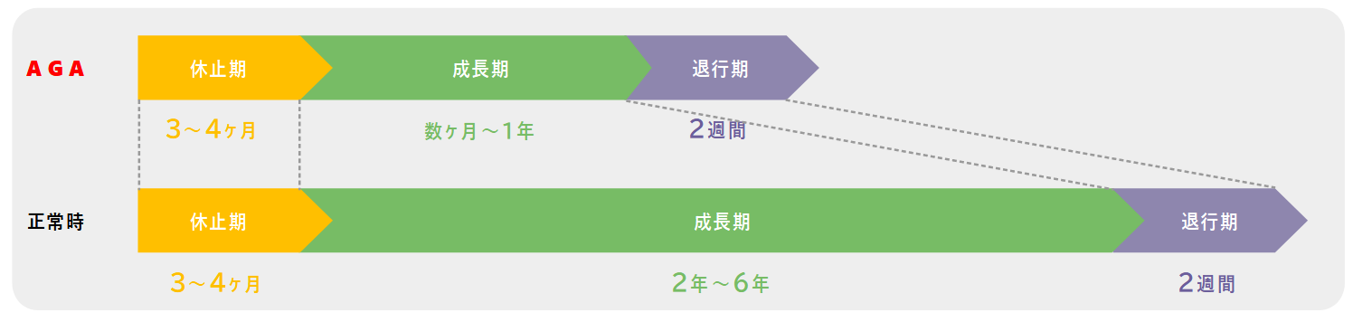 通常時とAGAの場合のヘアサイクル寿命の比較