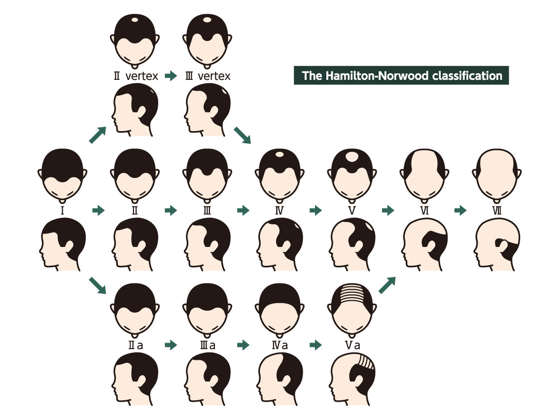 ハミルトン・ノーウッド分類